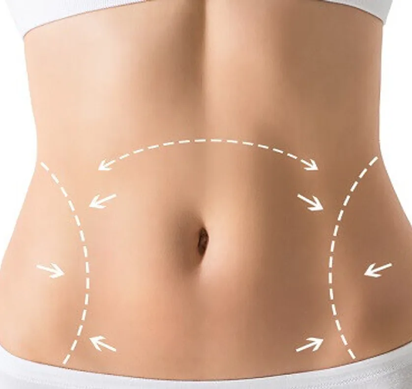 Abdominoplastia-Saiba-sobre-a-cirurgia-plastica-Mario-Farinazzo-1.jpg